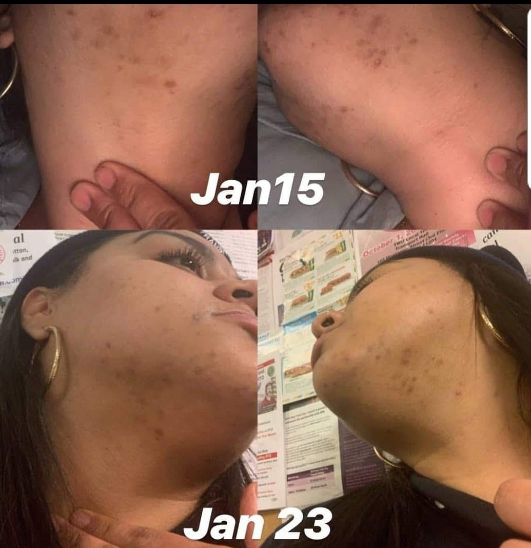 Tumeric Facial Scrub & Cleanser